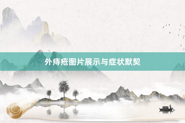 外痔疮图片展示与症状默契